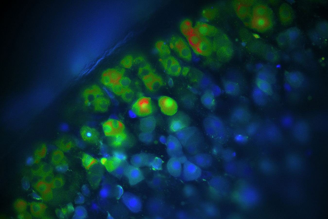 Kalzium-Messungen: Sind die Zellen blau, ist die Kalzium-Konzentration niedrig. Grüne und rote Zellen haben eine erhöhte Kalzium-Konzentration, was die Produktion von Aldosteron zur Folge hat. (Bildautorin: Audrey H. Soria)