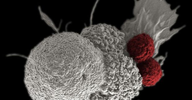 (c) Rita Elena Serda, National Institutes of Health, CC By.NC -2.0