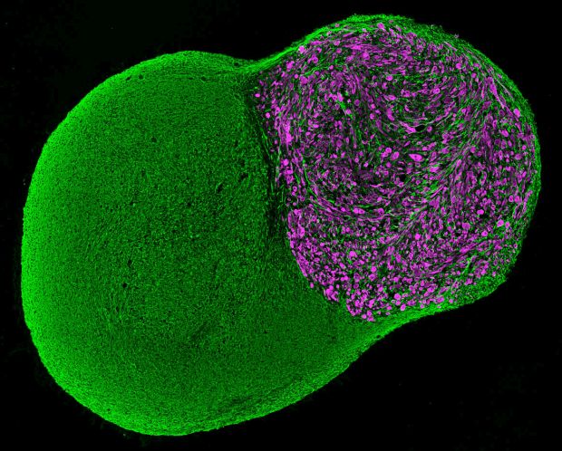 Neuromuskuläres Organoid, 100 Tage lang im Labor kultiviert, mit einem neuronalen (grün) und einem muskulären (violett) Teil. Jorge Miguel Faustino Martins, MDC