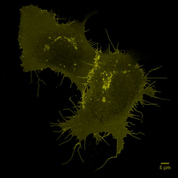 Two Human Embryonic Kidney cells expressing CXCR4 receptor (in dark yellow). © Paolo Annibale, Ali Isbilir, MDC