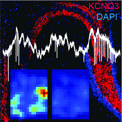Fig. Modified from Gao et al., 2021