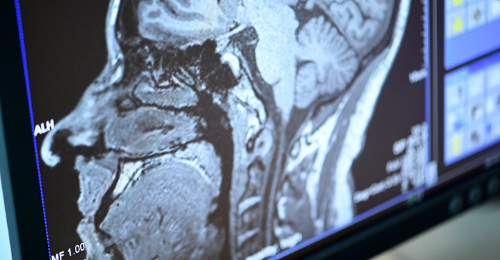 @ David Ausserhofer/MDC