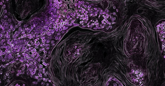 © National Cancer Institute / NIH