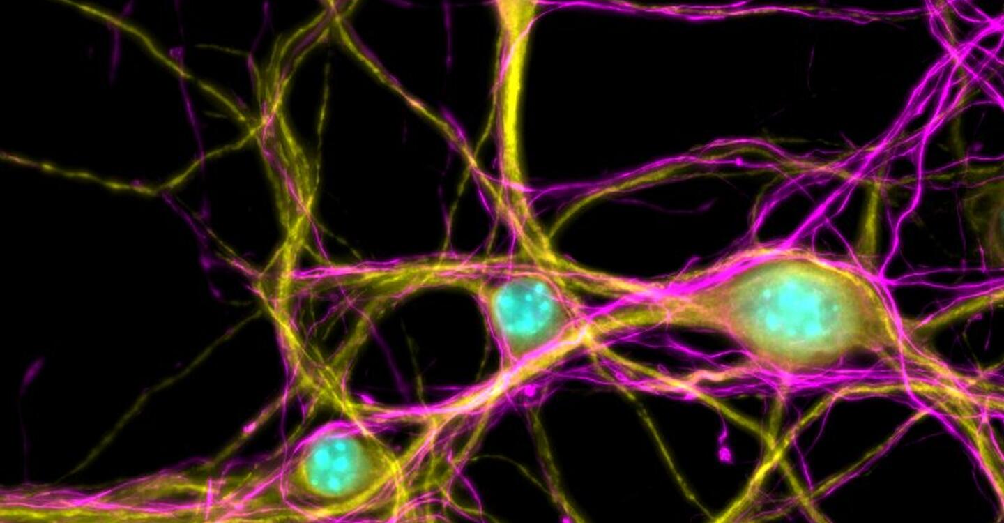 Copyright: Samantha Mendonsa, Max Delbrück Center