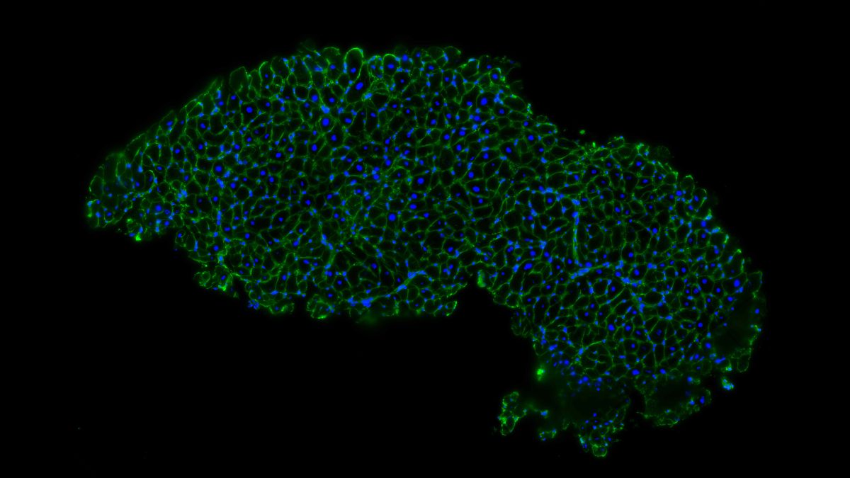 Foto: Eric Lindberg, Max Delbrück Center / LMU Klinikum