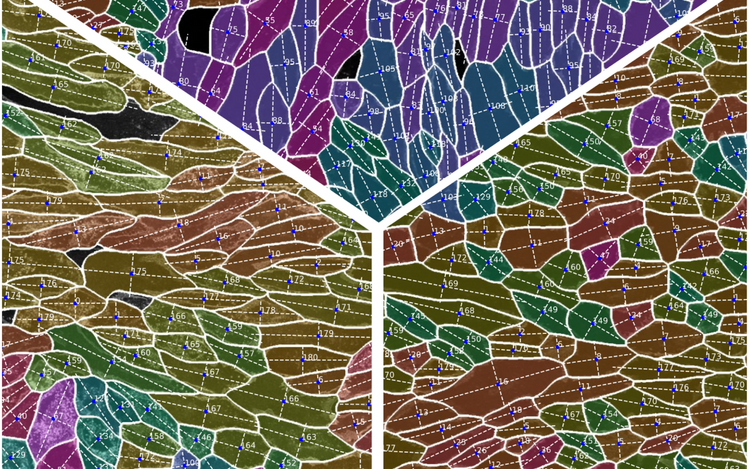 Wie sich Zellpolarität ändert, wenn Endothelzellen verschiedenen Scherkräften ausgesetzt sind – Bedingungen, die den Blutfluss nachahmen. © Julia Kraxner, Emir Akmeric (Gerhardt Lab), Jan Philipp Albrecht (Helmholtz Imaging)