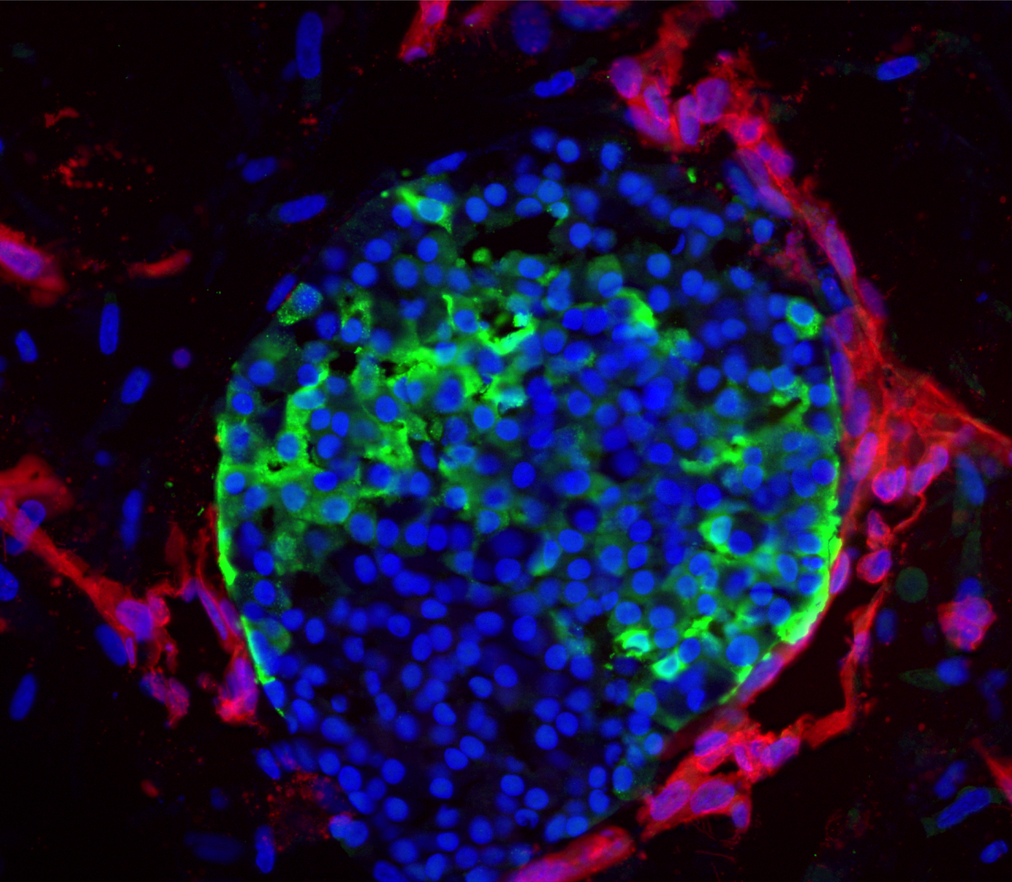 Das Forschungsteam hat geeignete Kulturbedingungen ermittelt, um vaskularisierte Stammzellinseln zu züchten. Das Bild zeigt die Blutgefäße (blau), die sich eng an die Inselzellen (grün) schmiegen. Foto: AG Sander