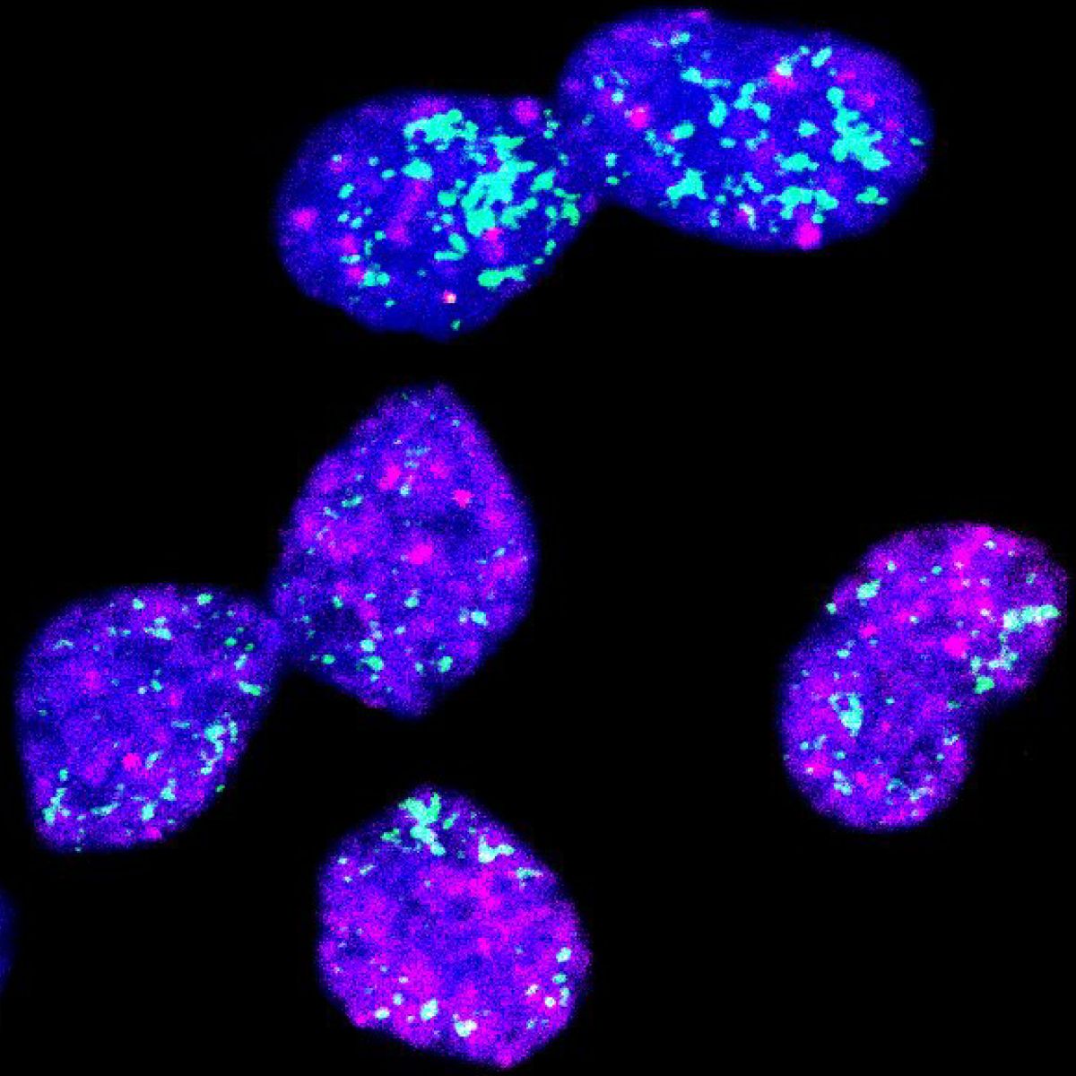 Neuroblastom-Zellen © Charité | Giulia Montuori