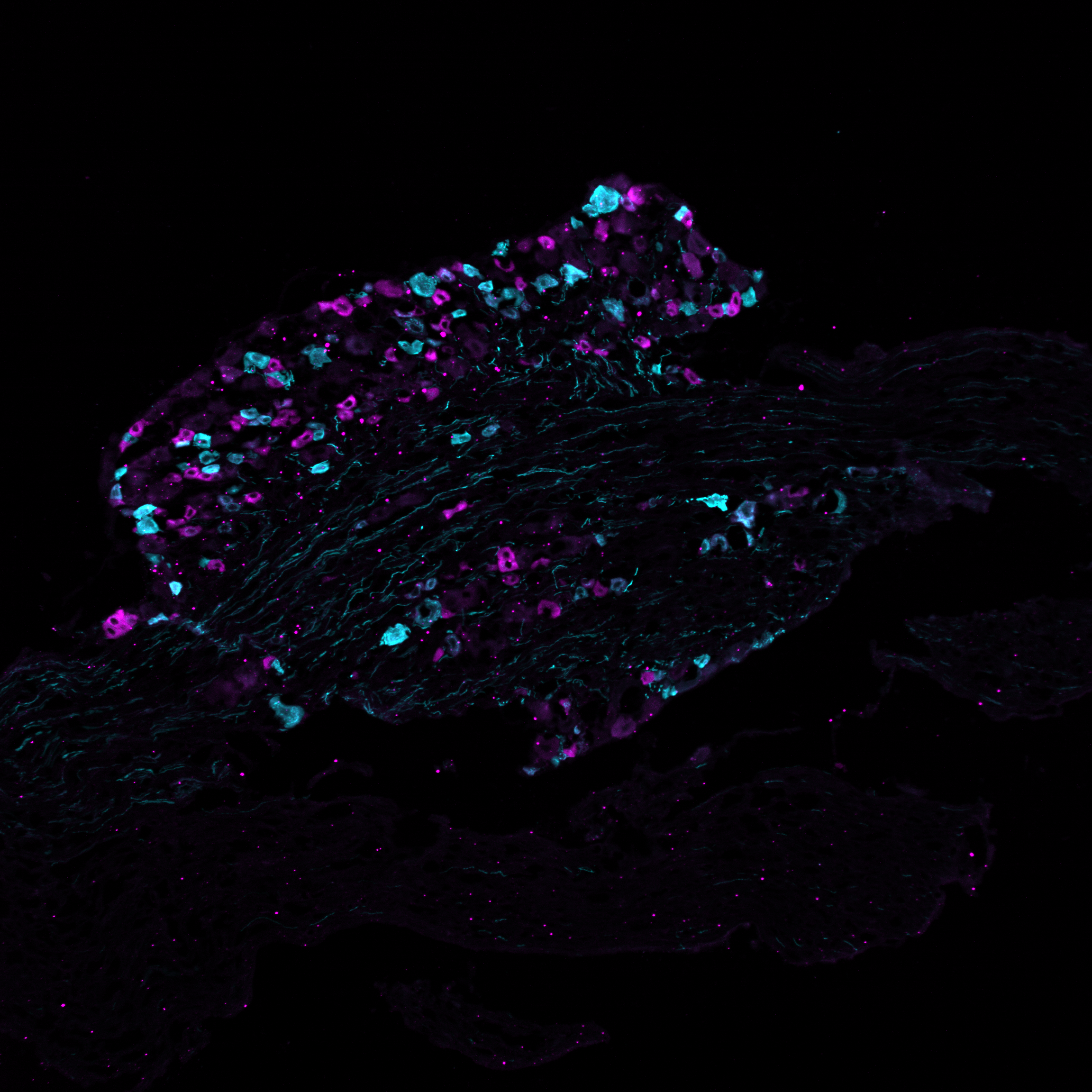 Section of a mouse dorsal root ganglion with two subtypes of pain receptors marked in cyan and magenta. © Sampurna Chakrabarti, Max Delbrück Center