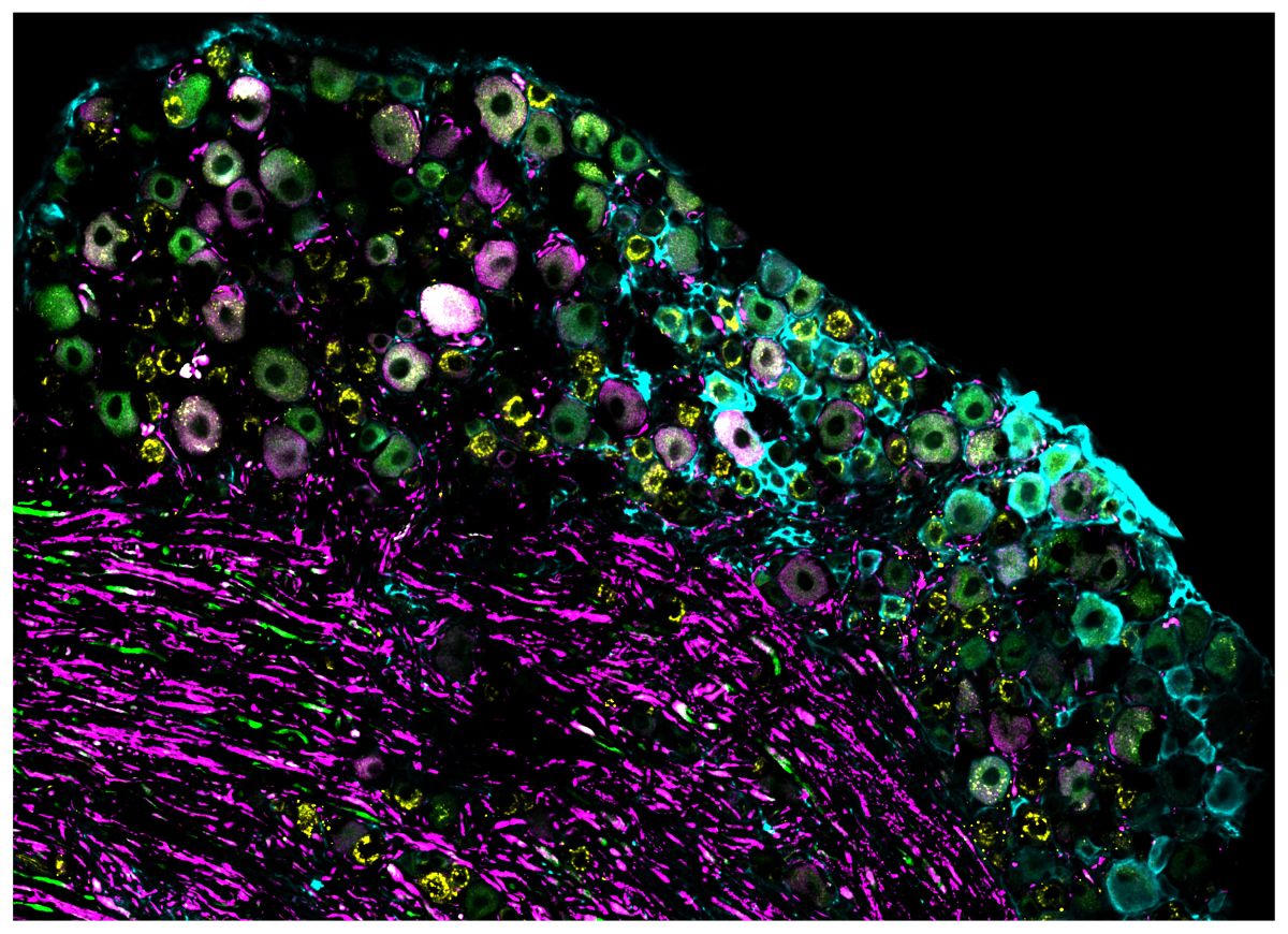 © Phillip Bokiniec, Whitmire lab, Queensland Brain Institute, University of Queensland